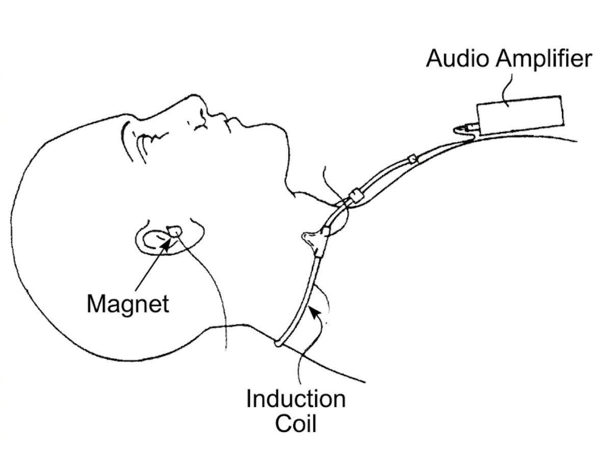 Schematic showing a human head with a small magnet in the ear, an induction coil around the neck, and an audio amplifier feeding the loop